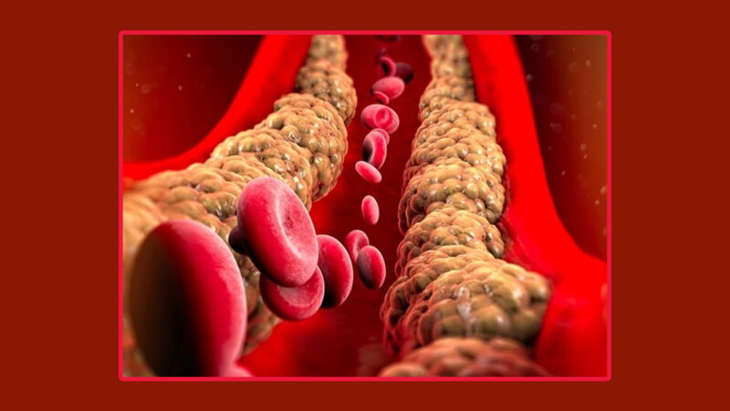 الدهون الثلاثية – Triglycerides